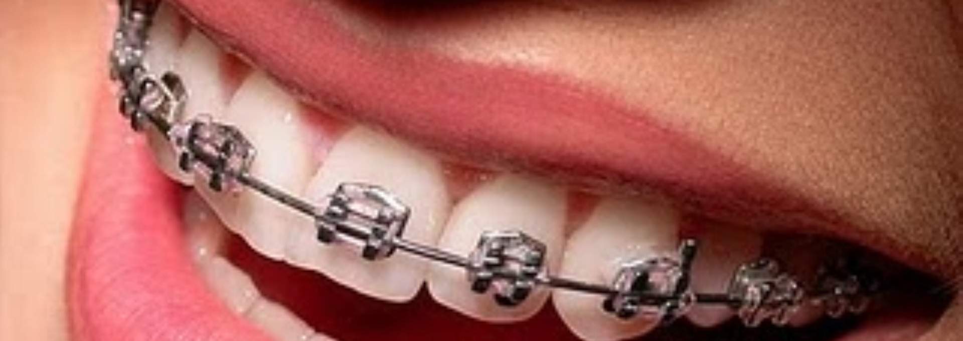 Female Dentist in Lenasia Female Dentist in Lenasia